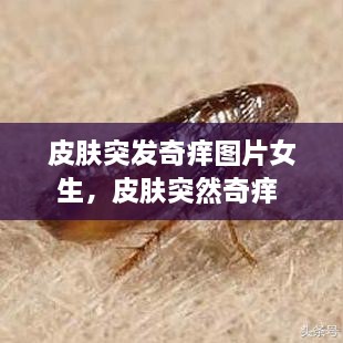 皮肤突发奇痒图片女生，皮肤突然奇痒 