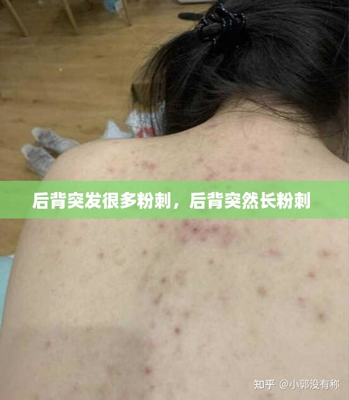 后背突发很多粉刺，后背突然长粉刺 