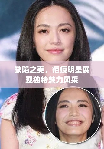 缺陷之美，疤痕明星展现独特魅力风采