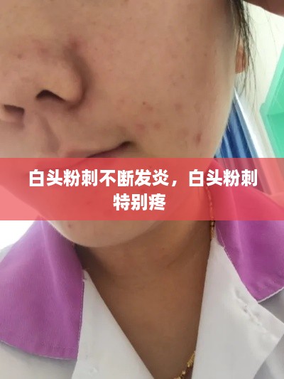 白头粉刺不断发炎，白头粉刺特别疼 
